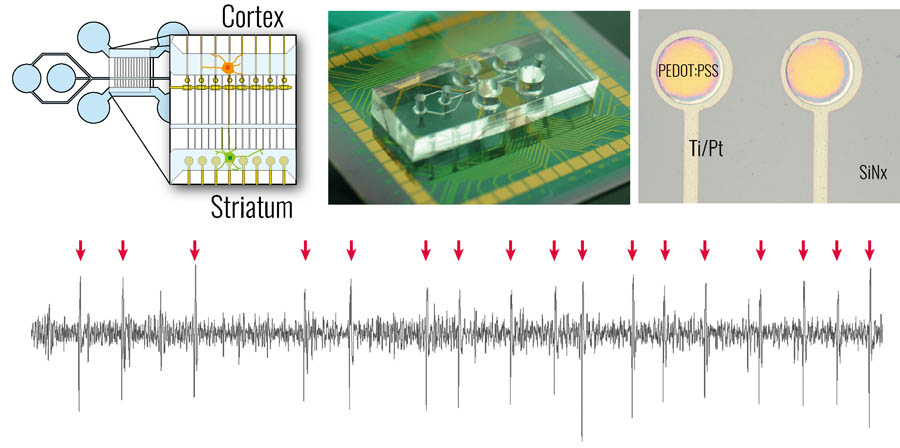 neuro chip